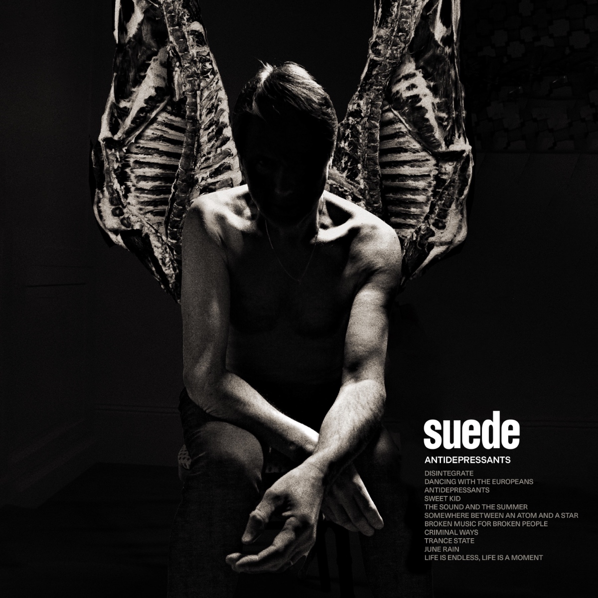 洋楽 Suede: Deluxe Edition 0001.jpg